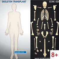 Скелетная трансплантация
